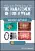 Practical_procedures_in_the_management_of_tooth_wear