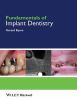 Fundamentals_of_implant_dentistry